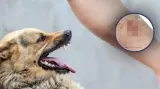 لم ينفع معه العلاج.. عضة كلب ضال تقتل شابا يشتغل بسوق الجملة بآسفي